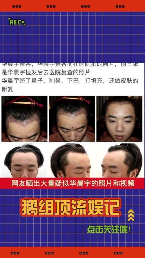 吃瓜爆料整容是真的吗,整容真相大揭秘